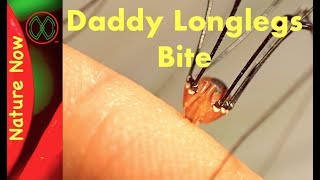 Summary of Daddy Long Legs by Jean Webster [upl. by Lauree]