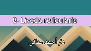 8 Livedo reticularis 👉 Dr Ahmed Anany [upl. by Ecirtak]