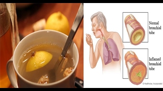 The 3 Ingredient Elixir that Can Clear Mucus from the Lungs and Strengthen the Immune System [upl. by Nezah533]