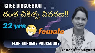 Case discussion  Flap procedure [upl. by Amarette326]