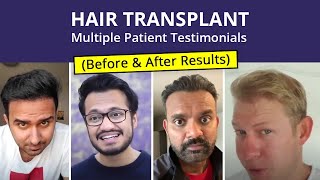 Hair Transplant  Patient Reviews  Medlinks  Before amp After Results  Multiple Client Testimonials [upl. by Aihtnic694]