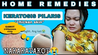 Paano gamutin ang KERATOSIS PILARIS also known as CHICKEN SKINHOME REMEDIES 40PhpTagalogRONA J [upl. by Larissa]