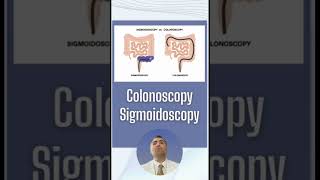 Sigmoidoscopy versus colonoscopy ￼ [upl. by Sully590]