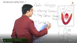 Aortic stenosis  Aortic valve disease  Pathophysiology Usmle step 1 [upl. by Harlan]