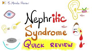 Nephritic Syndrome  APSGN RPGN IgAN Alport  Quick Review  5 Minute Review Series [upl. by Feenah]