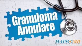 Granuloma Annulare ¦ Treatment and Symptoms [upl. by Seed259]