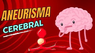 Aneurisma cerebral [upl. by Bryn]