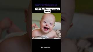 டவுன் syndrome கண்டறிய NIPT உதவுமா trisomy tamil [upl. by Lorolla]