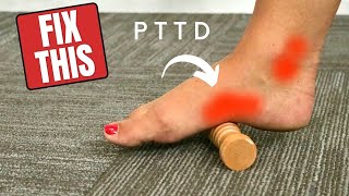 BEST Eccentric Exercise For Tibialis Posterior Tendon Dysfunction PTTD [upl. by Drofliw]