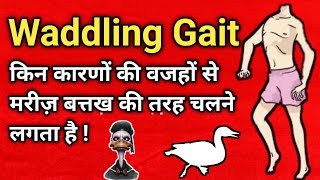 waddling gait explained in hindi  duck like walk  abnormal gait pattern [upl. by Erual309]