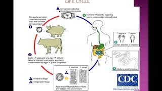 Tapeworm infestation and neurocysticercosis [upl. by Kellene292]