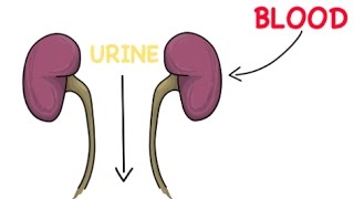 How do kidney stones form [upl. by Ahseneuq]