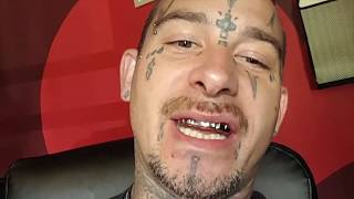 Review Bling Cartel Gold Teeth Grillz  BlingCartelcom [upl. by Fotina291]