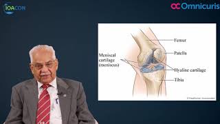 Osteoarthritis Hindi  IOACON 2017 [upl. by Pebrook645]