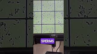 Identifying Sperm Motile vs Immotile Live Demonstration [upl. by Budding]