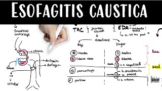 ESOFAGITIS POR CAUSTICOS acidos bases [upl. by Nesyt182]