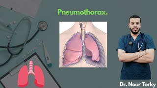 4Pneumothorax [upl. by Nnayelhsa]