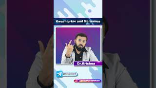 Kwashiorkor Vs Marasmus  Quick Bites [upl. by Metts]