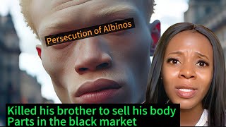 The Killing and Persecution of Albinos in Eastern Africa A True Story [upl. by Sej]