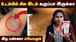 கருமை போக தினமும் இத பண்ணுங்க  Underarm Darkness  Neck Darkness  Skin care [upl. by Zobkiw398]