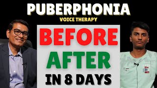 BeforeAfter Puberphonia Speech Therapy  Within 8 Days  SLPSanjayKumar  Speech Pathologist India [upl. by Lancaster]