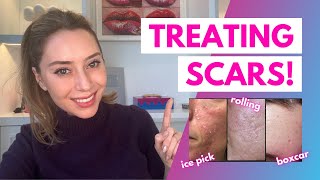 How To Treat Scars Flat Depressed Raised and Keloids  Dr Shereene Idriss [upl. by Aleyam685]