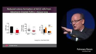 Mechanism of Alveolar Epithelial Cell Renewal Impact on ILD  Paul Noble MD [upl. by Church]