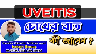 Uveitis কি চোখের বাত কি Treatment of Uveitis  Iritis  CHOROIDITIS  Panuveitis [upl. by Atisor]