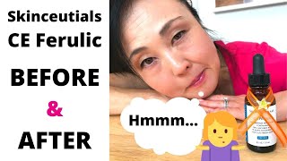 SkinceuticalsCE Ferulic Worth it Before and After [upl. by Eseila]