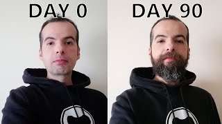 I GREW THIS BEARD IN A YEAR Beard Growth 1 Year Timelapse [upl. by Uttica]