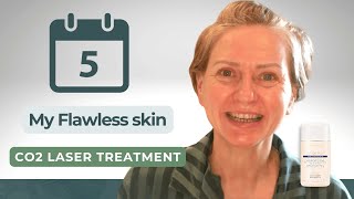 5 Days to FLAWLESS Skin with CO2 Laser Treatment [upl. by Eizle]