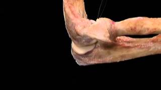 Aclands Video Atlas of Human Anatomy Elbow [upl. by Adliw]