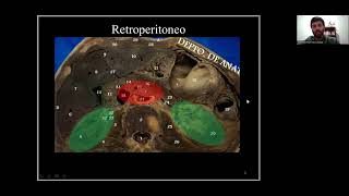 Retroperitoneo  Anatomía [upl. by Hendel]