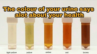 The colour of your urine says alot about your health [upl. by Biegel]