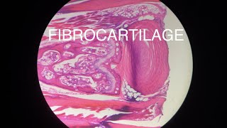 FIBROCARTILAGE [upl. by Krever61]