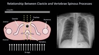 How to Interpret a Chest XRay Lesson 3  Assessing Technical Quality [upl. by Zeralda727]