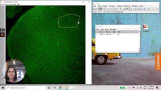 ImageJ  Densitometry using MAX projection image [upl. by Alberic66]