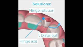 Hinge Rotation Explained [upl. by Notsecnirp]