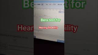 Bera test for hearing disability Percentage [upl. by Benjie]