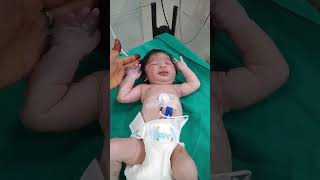 Breech Delivery  उल्टा जन्मा हुआ बच्चा  Baby care [upl. by Lerraj]