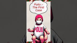 When Did Polio Strike shorts trending reels [upl. by Dasa359]