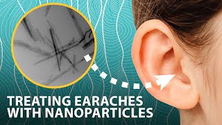 Treating earaches with nanoparticles that generate antiseptic on demand  Headline Science [upl. by Sidras]