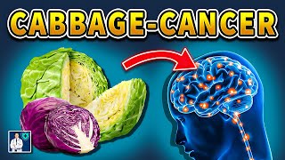 Never Eat Cabbage Like This 🥬 It Causes Cancer and Memory Loss Solution Dr John [upl. by Cohl]