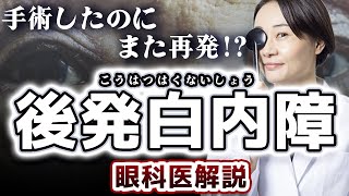 後発白内障の初期症状・時期・原因・レーザー手術治療を眼科医が解説 [upl. by Stoffel227]