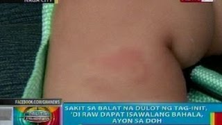 BP Sakit sa balat na dulot ng taginit di dapat isawalang bahala ayon sa DOH [upl. by Attegroeg]