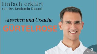 Gürtelrose  Aussehen und Ursachen  Einfach erklärt von Dr Durani Facharzt für Hautkrankheiten [upl. by Edialeda]