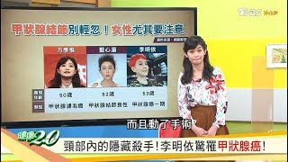 頸部內的隱藏殺手！李明依驚罹甲狀腺癌！ 健康20 20200501 完整版 [upl. by Anera]