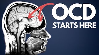 OCD explained for beginners  how I wish I was taught [upl. by Mloclam]