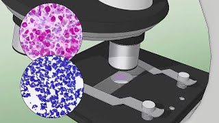 Commensal bacteria and infection [upl. by Alistair]