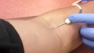 Donating Blood Needle Insertion [upl. by Chemaram]